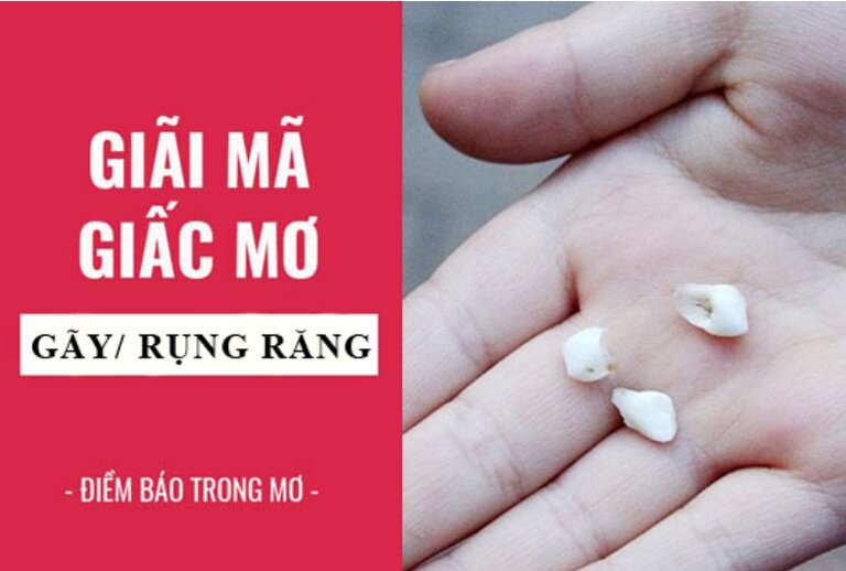 Nằm mơ thấy rụng răng đánh số mấy để trúng đậm?