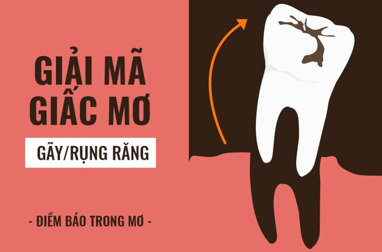 Rụng răng là điềm xui hay là điềm hên?